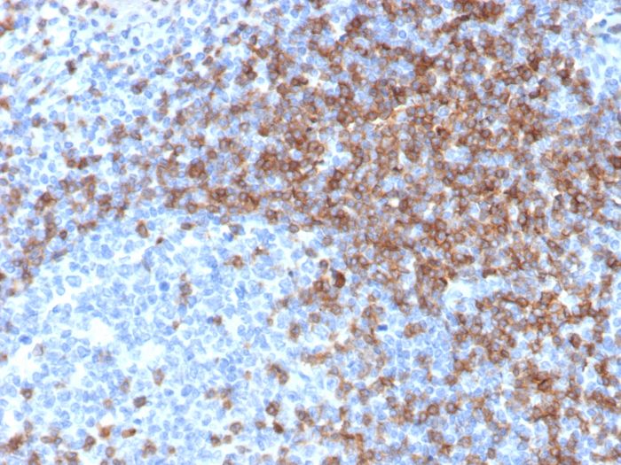 IHC analysis of formalin-fixed, paraffin-embedded human tonsil. CD3 epsilon antibody (rC3e/6966). HIER: Tris/EDTA, pH9.0, 45min. Secondary: HRP-polymer, 30min. DAB, 5min.