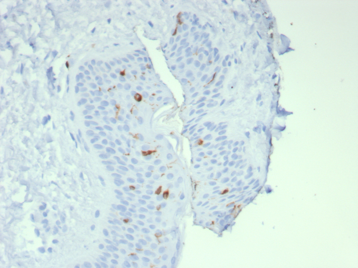 Formalin-fixed, paraffin-embedded human skin stained with Langerin/CD207 antibody (LGRN/7541). HIER: Tris/EDTA, pH9.0, 45min. Secondary: HRP-polymer, 30min. DAB, 5min.