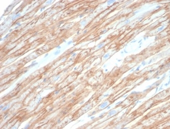 Formalin-fixed, paraffin-embedded human heart muscle stained with Dystrophin antibody (DMD/6270). HIER: Tris/EDTA, pH9.0, 45min. Secondary: HRP-polymer, 30min. DAB, 5min.