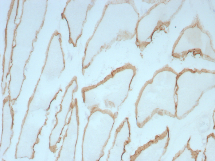 Formalin-fixed, paraffin-embedded human skeletal muscle stained with Dystrophin antibody (DMD/8773R). HIER: Tris/EDTA, pH9.0, 45min. 2: HRP-polymer, 30min. DAB, 5min.