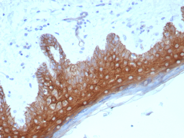 Formalin-fixed, paraffin-embedded human skin stained with Desmoglein-1 antibody (DSG1/8576R).