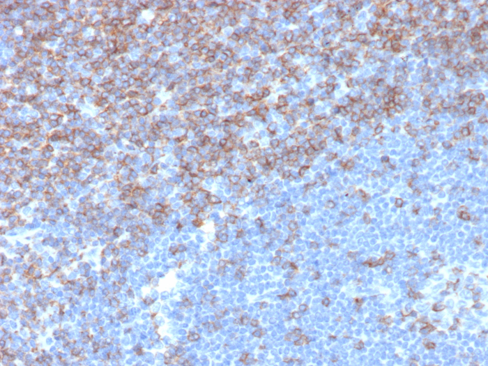 Formalin-fixed, paraffin-embedded human tonsil stained with CD5 antibody (rC5/6976). HIER: Tris/EDTA, pH9.0, 45min. Secondary: HRP-polymer, 30min. DAB, 5min.
