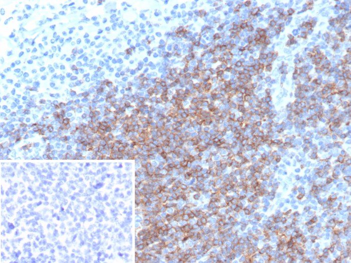 Formalin-fixed, paraffin-embedded human tonsil stained with CD5 antibody (rC5/6976). Inset: PBS instead of primary antibody; secondary only negative control.