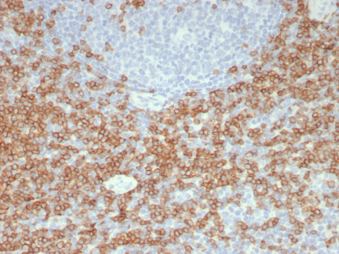 Formalin-fixed, paraffin-embedded human tonsil stained with CD5 antibody (C5/8117R). HIER: Tris/EDTA, pH9.0, 45min. 2: HRP-polymer, 30min. DAB, 5min.