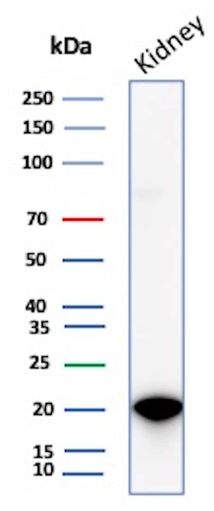 Western blot analysis of Human Kidney lysates using AlphaB Crystallin/CRYAB Antibody (CRYAB/4665) - Azide and BSA Free. 