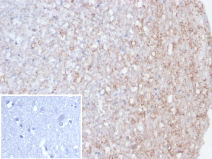Formalin-fixed, paraffin-embedded human brain stained with Calretinin antibody (rCALB2/7123). Inset: PBS instead of primary, secondary negative control.