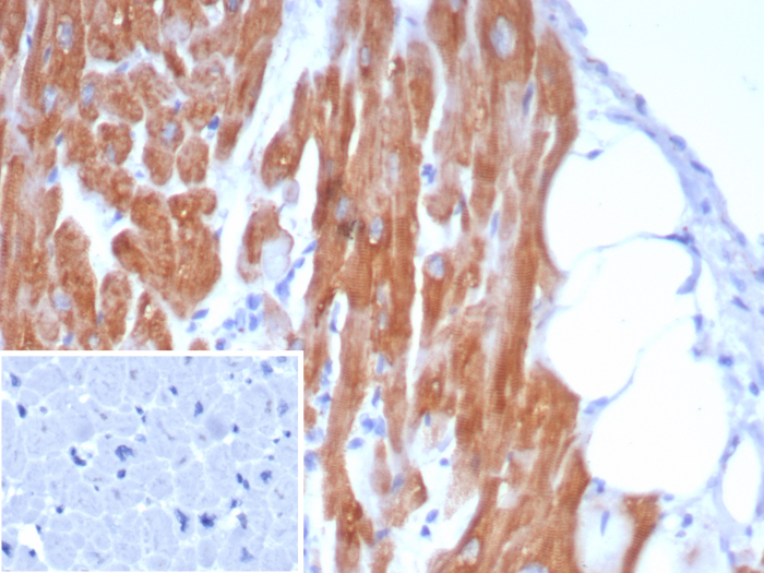 Formalin-fixed, paraffin-embedded human heart stained with AlphaB Crystallin/CRYAB antibody (CRYAB/7917). Inset: PBS instead of primary antibody; secondary only negative control.