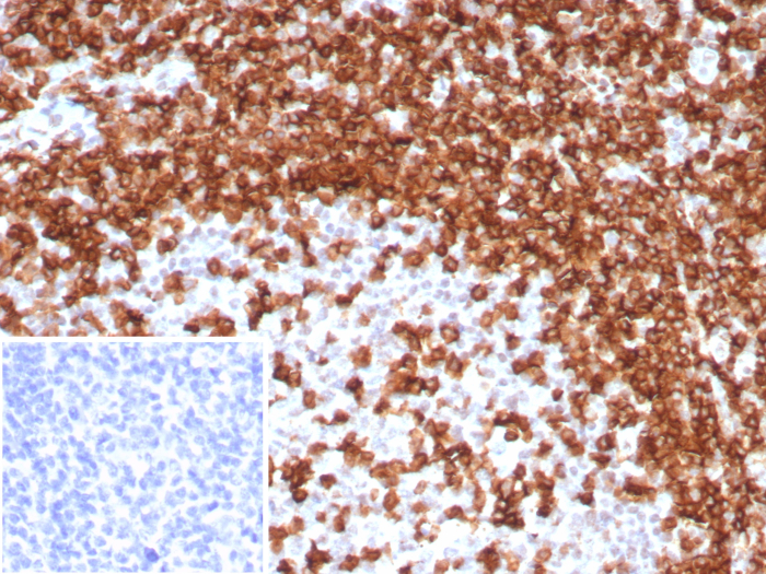 Formalin-fixed, paraffin-embedded human tonsil stained with CD45RA antibody (T200/8144R). Inset: PBS instead of primary antibody; secondary only negative control.