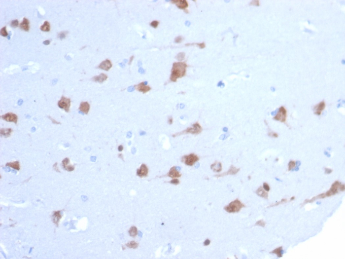 Formalin-fixed, paraffin-embedded human brain stained with RBFOX3/NeuN antibody (NEUN/7167). HIER: Tris/EDTA, pH9.0, 45min. Secondary: HRP-polymer, 30min. DAB, 5min.