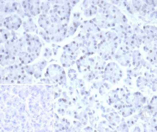 Formalin-fixed, paraffin-embedded human pancreas stained with PHOX2B antibody (PHOX2B/7792R). Inset: PBS instead of primary antibody; secondary only negative control.