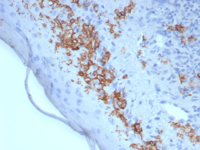 Formalin-fixed, paraffin-embedded human skin stained with CD1a antibody (rC1A/8110). HIER: Tris/EDTA, pH9.0, 45min. Secondary: HRP-polymer, 30min. DAB, 5min.
