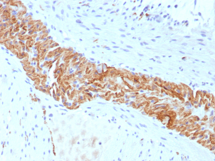 Formalin-fixed, paraffin-embedded human colon stained with NCAM-1/CD56 antibody (rNCAM1/8655). HIER: Tris/EDTA, pH9.0, 45min. Secondary: HRP-polymer, 30min. DAB, 5min.