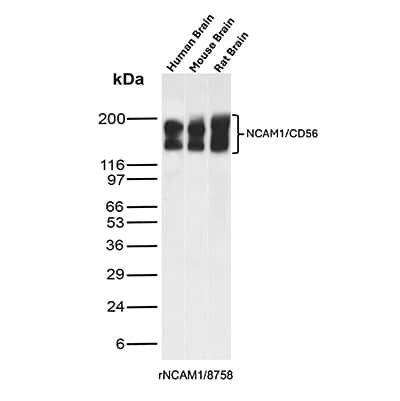 Western blot analysis of  Human Brain, Mouse Brain and Rat Brain tissue lysates using NCAM-1/CD56 Antibody (rNCAM1/8758) - Azide and BSA Free.