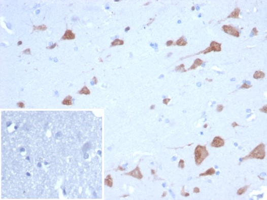 Formalin-fixed, paraffin-embedded human brain stained with RBFOX3/NeuN antibody (NEUN/7168). Inset: PBS instead of primary antibody; secondary only negative control.