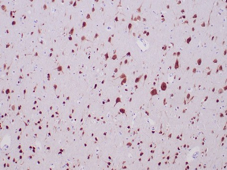 Formalin-fixed, paraffin-embedded human cerebrum stained with RBFOX3/NeuN antibody (NEUN/7168). HIER: Tris/EDTA, pH9.0, 45min. Secondary: HRP-polymer, 30min. DAB, 5min.