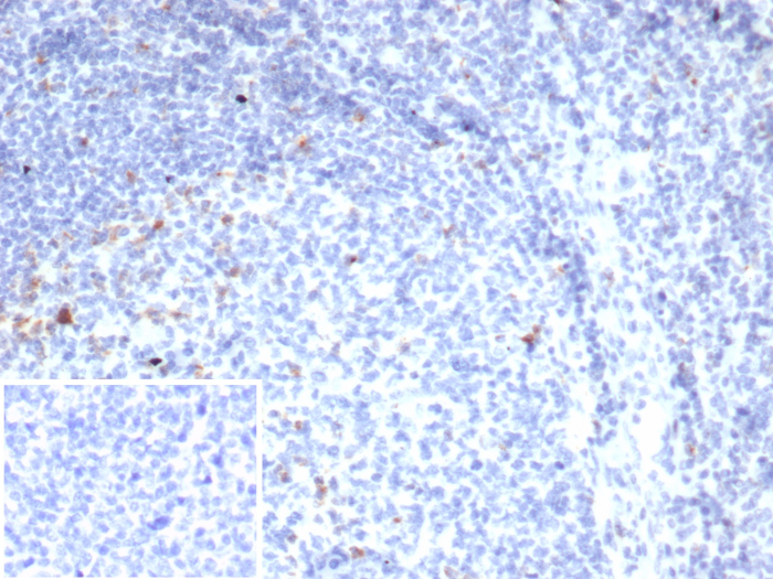 Formalin-fixed, paraffin-embedded human tonsil stained with CTLA-4 antibody (rCTLA4/7219). Inset: PBS instead of primary antibody; secondary only negative control.