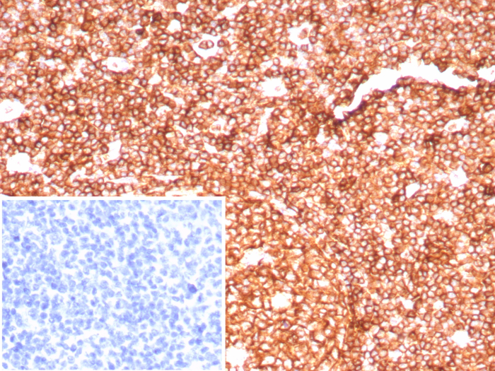 Formalin-fixed, paraffin-embedded human tonsil stained with CD45RA antibody (PTPRC/8699R). Inset: PBS instead of primary antibody; secondary only negative control.