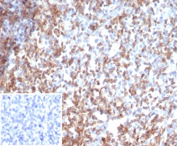 IHC analysis of formalin-fixed, paraffin-embedded human tonsil. Cell surface stained with CD2 antibody (rLFA2/7147) Inset: PBS instead of primary antibody; secondary only negative control.