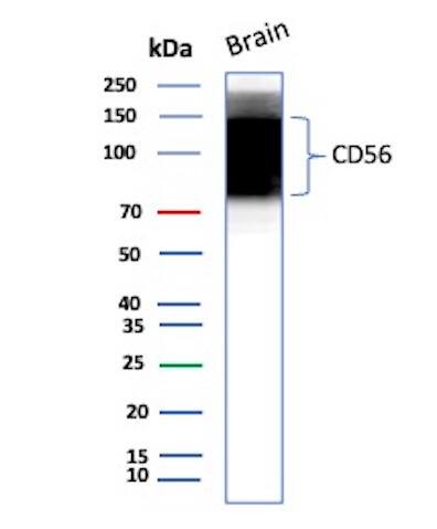 Western blot analysis of Human Brain tissue lysates using NCAM-1/CD56 Antibody (NCAM1/8392R) - Azide and BSA Free.