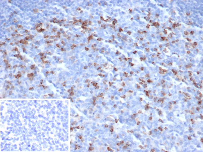 Formalin-fixed, paraffin-embedded human tonsil stained with CTLA-4 antibody (CTLA4/6864R). Inset: PBS instead of primary antibody; secondary only negative control.