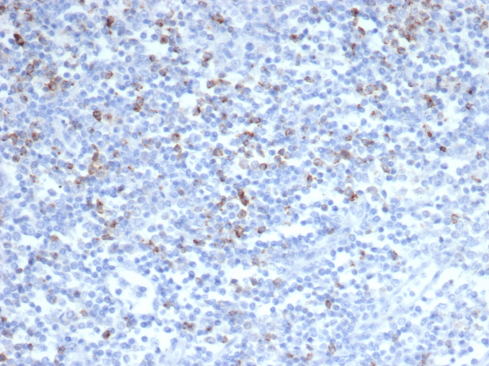 Formalin-fixed, paraffin-embedded human tonsil stained with CTLA-4 antibody (CTLA4/6864R). HIER: Tris/EDTA, pH9.0, 45min. Secondary: HRP-polymer, 30min. DAB, 5min