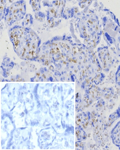 Formalin-fixed, paraffin-embedded human placenta stained with BCMA/TNFRSF17 antibody (CD269/8125R). Inset: PBS instead of primary antibody; secondary only negative control.