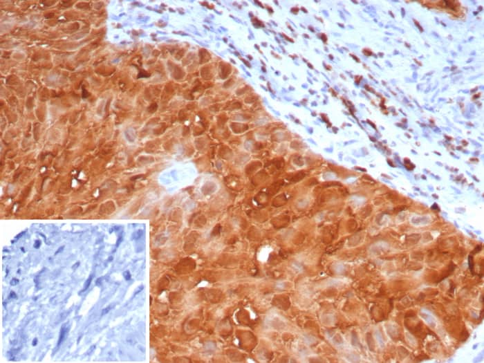 Formalin-fixed, paraffin-embedded human placenta stained with S100P Recombinant Mouse Monoclonal Antibody (S100P/7373). Inset: PBS instead of primary antibody; secondary only negative control.