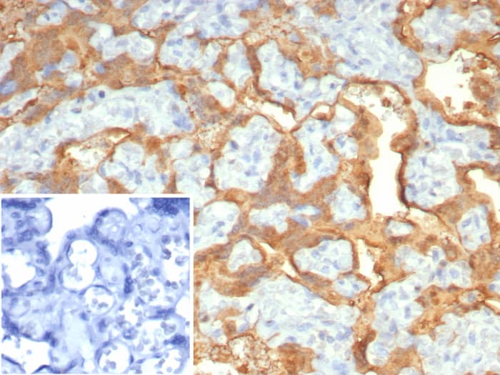 Formalin-fixed, paraffin-embedded human placenta stained with S100P Recombinant Mouse Monoclonal Antibody (S100P/7373). Inset: PBS instead of primary antibody; secondary only negative control.