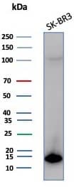 Western blot analysis of SK-BR3 cell lysate using S100P Recombinant Mouse Monoclonal Antibody (S100P/7373).