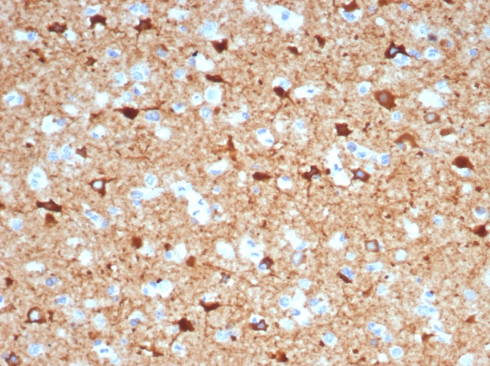 Formalin-fixed, paraffin-embedded human brain stained with NECAB1 antibody (NECAB1/7680). HIER: Tris/EDTA, pH9.0, 45min. Secondary: HRP-polymer, 30min. DAB, 5min.
