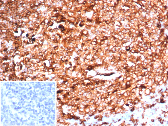 Formalin-fixed, paraffin-embedded human tonsil stained with HLA-DR antibody (HLA-DRA/6840R). Inset: PBS instead of primary antibody; secondary only negative control.