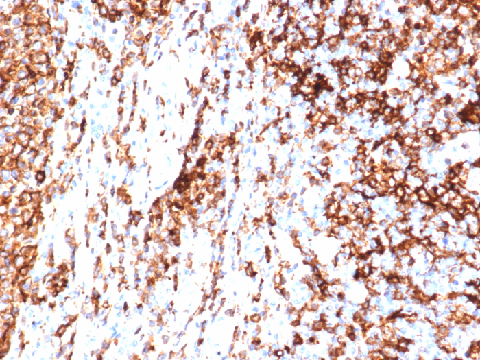 Formalin-fixed, paraffin-embedded human tonsil stained with HLA-DR antibody (HLA-DRA/6840R). HIER: Tris/EDTA, pH9.0, 45min. Secondary: HRP-polymer, 30min. DAB, 5min.