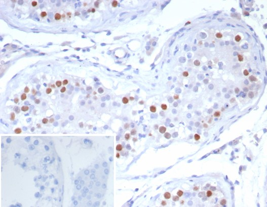 Formalin-fixed, paraffin-embedded human testis stained with PRAME antibody (PRAME/6928R). Inset: PBS instead of primary antibody; secondary only negative control.