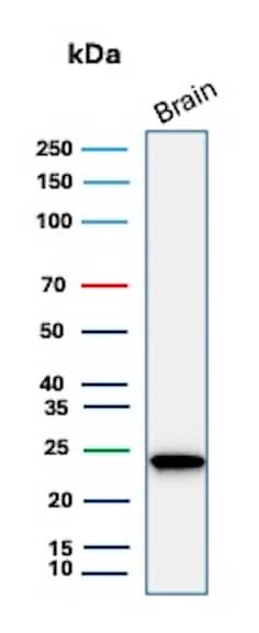 Western Blot Analysis of human brain tissue lysate using UCH-L1/PGP9.5 Antibody (UCHL1/7076R) - Azide and BSA Free. 
