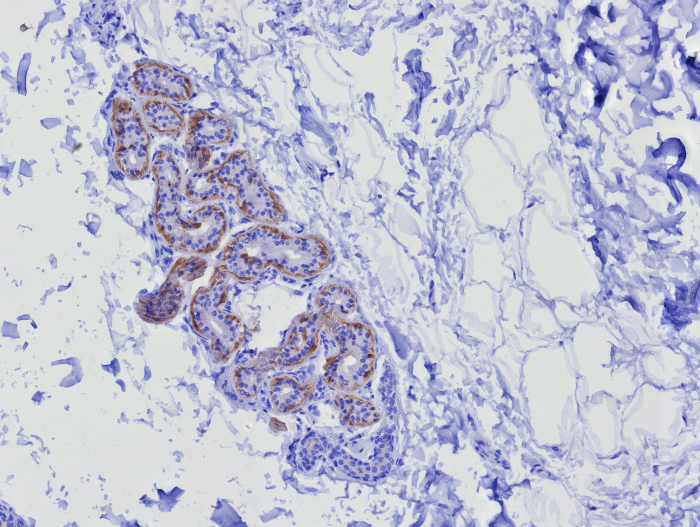 Formalin-fixed, paraffin-embedded human skin stained with Cytokeratin 17 antibody (KRT17/8346R). HIER: Tris/EDTA, pH9.0, 45min. 2: HRP-polymer, 30min. DAB, 5min.