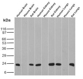 Western Blot Analysis of Human Brain, Mouse Brain, Rat Brain, Human Kidney, Mouse Kidney, Rat Kidney, Human Lungs, Mouse Lungs and Rat Lungs tissue lysates using Ferritin Heavy Chain Antibody (FTH/8700R) - Azide and BSA Free.