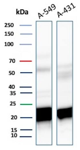 Western Blot Analysis of A-549 and A-431 lysate using Ferritin Heavy Chain Antibody (FTH/8700R) - Azide and BSA Free.