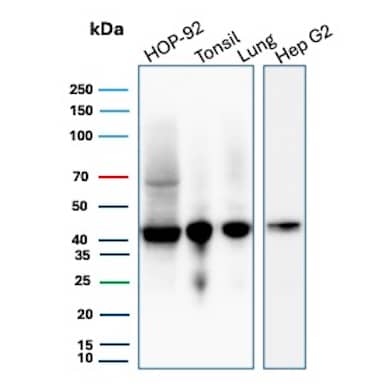 Western Blot Analysis of HOP-92, Tonsil, Lung and Hep G2 lysates using HLA ABC Antibody (MHC-I/8147R) - Azide and BSA Free.
