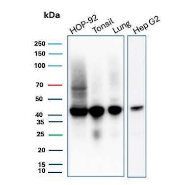 Western Blot Analysis of HOP-92, Tonsil, Lung and Hep G2 lysates using HLA ABC Antibody (MHC-I/8366R) - Azide and BSA Free.