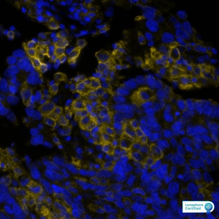 PD-L1 was detected in immersion fixed paraffin-embedded sections of human Lung Tumor using Rabbit Anti-Human PD-L1, Monoclonal Antibody at 5ug/mL at 37 � Celsius for 4 minutes. Before incubation with the primary antibody, tissue underwent an all-in-one dewaxing and antigen retrieval preprocessing using PreTreatment Module (PT Module) and Dewax and HIER Buffer H (pH 9; Epredia Catalog # TA-999-DHBH). Tissue was stained using the Alexa Fluor� Plus 647 Goat anti-Rabbit IgG Secondary Antibody at 1:200 at 37 � Celsius for 2 minutes. (Yellow; Lunaphore Catalog # DR647RB) and counterstained with DAPI (blue; Lunaphore Catalog # DR100). Specific staining was localized to the membrane. Protocol available in COMET� Panel Builder.
