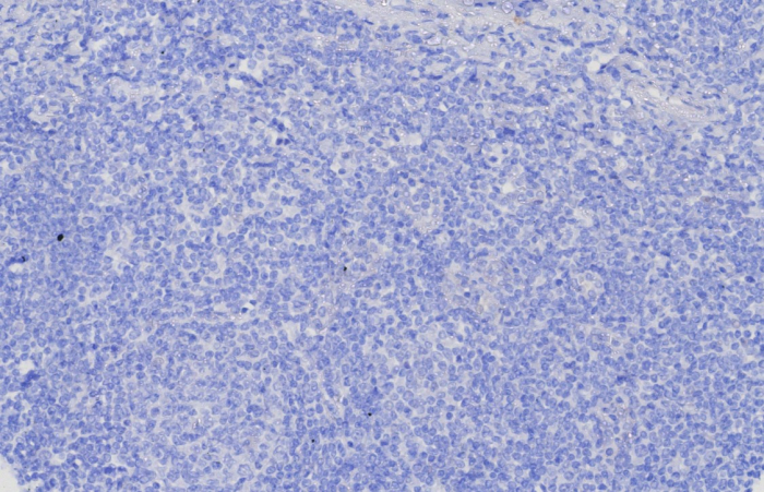 IHC analysis of formalin-fixed, paraffin-embedded human brain. Negative tissue control using Glypican 3 antibody (GPC3/8127R) at 2ug/ml in PBS for 30min RT. HIER: Tris/EDTA, pH9.0, 45min. 2: HRP-polymer, 30min. DAB, 5min.