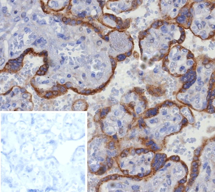 Formalin-fixed, paraffin-embedded human placenta stained with Glypican 3 antibody (GPC3/8363R). Inset: PBS instead of primary antibody; secondary only negative control.