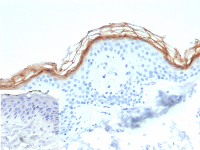 Formalin-fixed, paraffin-embedded human skin stained with Kallikrein 7 antibody (KLK7/4693). Inset: PBS instead of primary antibody; secondary only negative control.