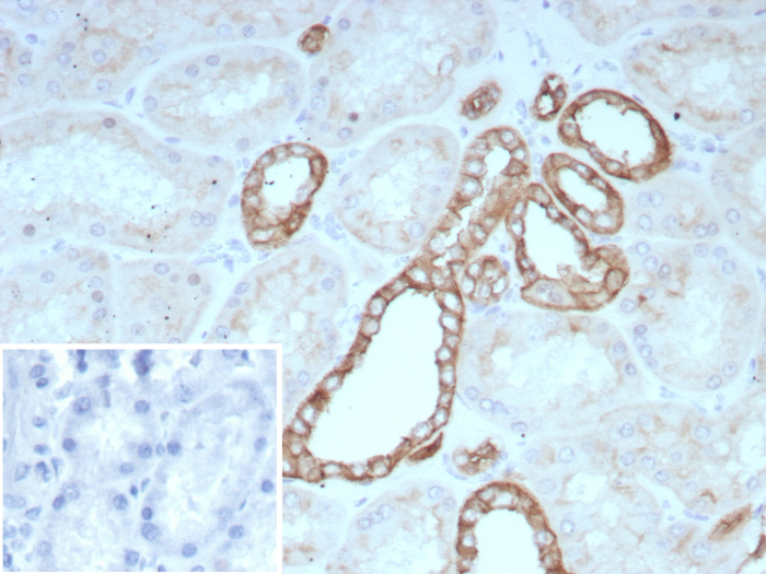 Formalin-fixed, paraffin-embedded human kidney stained with Occludin antibody (rOCLN/8776). Inset: PBS instead of primary antibody; secondary only negative control.