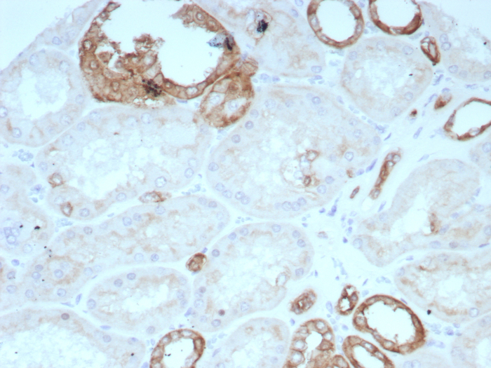 Formalin-fixed, paraffin-embedded human kidney stained with Occludin antibody (rOCLN/8776). HIER: Tris/EDTA, pH9.0, 45min. Secondary: HRP-polymer, 30min. DAB, 5min.