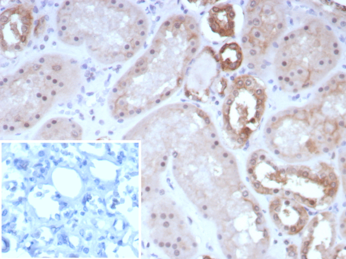 Formalin-fixed, paraffin-embedded human kidney stained with Occludin antibody (rOCLN/8525). Inset: PBS instead of primary antibody; secondary only negative control.