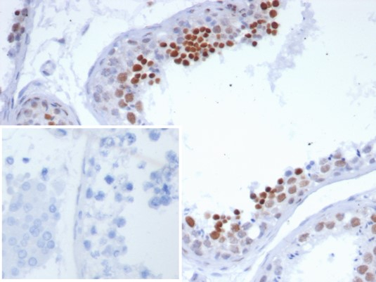 Formalin-fixed, paraffin-embedded human testis stained with SNURPORTIN1 antibody (SNUPN/7351R). Inset: PBS instead of primary antibody; secondary only negative control.