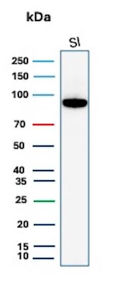 Western Blot Analysis of human small intestine tissue lysate using Cadherin-17 Antibody (rCDH17/8512) - BSA Free. 