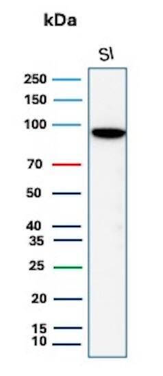 Western Blot Analysis of  human small intestine tissue lysate using Cadherin-17 Antibody (rCDH17/8514) - BSA Free. 