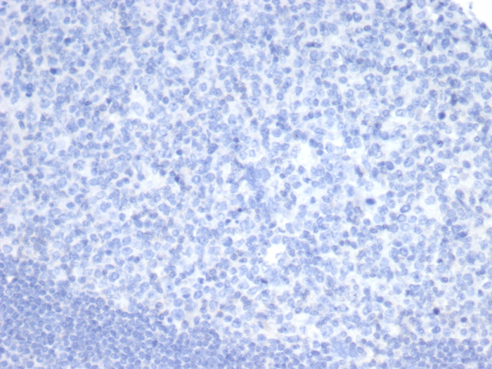 Olig2 antibody (OLIG2/7366R).0 nTPM). Negative tissue control using OLIG2 Recombinant Rabbit Monoclonal (OLIG2/7366R). HIER: Tris/EDTA, pH9.0, 45min. Secondary: HRP-polymer, 30min. DAB, 5min.